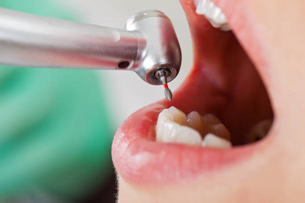 Best Emergency Broken Tooth Repair in Jackson, WI